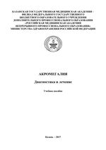 Акромегалия